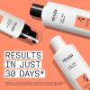 imageNioxin Scalp  Hair Thickening System Kits  For Natural Colored ampamp Damaged Hair with Light to Progressed Thinning  Strengthen ampamp Boost Hair Density with Niacinamide ampamp Biotin  1 Month SupplySystem 4 Kit