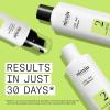 imageNioxin Scalp  Hair Thickening System Kits  For Natural Colored ampamp Damaged Hair with Light to Progressed Thinning  Strengthen ampamp Boost Hair Density with Niacinamide ampamp Biotin  1 Month SupplySystem 2 Kit