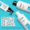 imageNioxin Shampoo ampamp Conditioner Prepack For Natural Colored ampamp Damaged Hair with Light to Progressed Thinning Strengthen ampamp Boost Hair Density with Niacinamide ampamp Biotin Pumps IncludedSystem 3 Kit