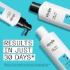 imageNioxin Scalp  Hair Thickening System Kits ampamp Root Lifting Styling Spray Bundle  For Thicker Fuller Hair  Strengthen Boost Hair Density Add Volume with Strong Hold  3 Month SupplySystem 3 Kit